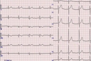 Khám tim mạch và đo ECG cho sản phụ